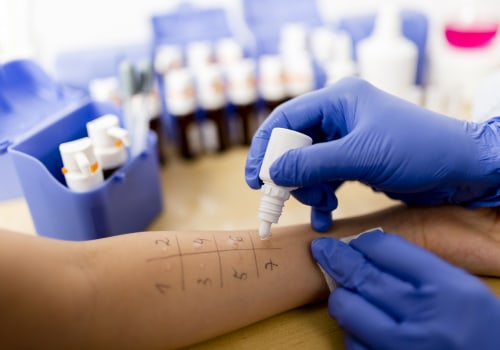 Understanding the Differences Between Skin Prick Tests and Blood Tests for Honey Allergy